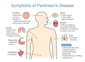 Parkinsons disease symptoms